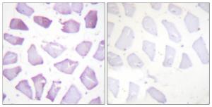 Immunohistochemical analysis of paraffin-embedded human skeletal muscle using Anti-PEA-15 (phospho Ser116) Antibody. The right hand panel represents a negative control, where the antibody was pre-incubated with the immunising peptide