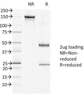 SDS-PAGE analysis of Anti-Desmoglein 1 Antibody [27B2] under non-reduced and reduced conditions; showing intact IgG and intact heavy and light chains, respectively. SDS-PAGE analysis confirms the integrity and purity of the Antibody