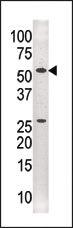 Anti-TRIM33 Rabbit Polyclonal Antibody