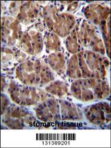 Anti-SOCS4 Rabbit Polyclonal Antibody