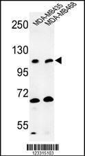 Anti-EXTL3 Rabbit Polyclonal Antibody (AP (Alkaline Phosphatase))