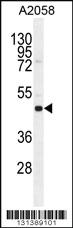 Anti-SOCS4 Rabbit Polyclonal Antibody