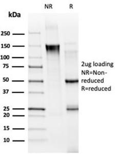 SDS-PAGE analysis of Anti-MED21 Antibody [PCRP-MED21-4B5] under non-reduced and reduced conditions; showing intact IgG and intact heavy and light chains, respectively SDS-PAGE analysis confirms the integrity and purity of the antibody