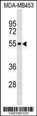 Anti-IL5RA Rabbit Polyclonal Antibody (HRP (Horseradish Peroxidase))