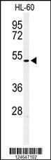 Anti-HOXA3 Rabbit Polyclonal Antibody (AP (Alkaline Phosphatase))