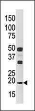 Anti-NME3 Rabbit Polyclonal Antibody