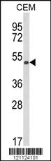 Anti-KMO Rabbit Polyclonal Antibody [clone: 383CT22.2.1]