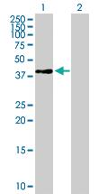 Anti-RPSAP58 Mouse Polyclonal Antibody