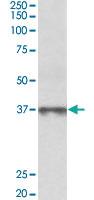 Anti-MAT2B Goat Polyclonal Antibody