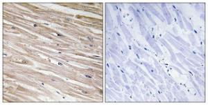 Immunohistochemical analysis of paraffin-embedded human heart using Anti-PEA-15 (phospho Ser104) Antibody. The right hand panel represents a negative control, where the antibody was pre-incubated with the immunising peptide.