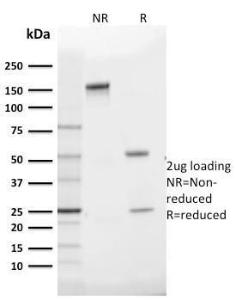 Antibody anti-GLUT1 GLUT12475 BSA 100 µg