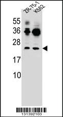 Anti-FRAT2 Rabbit Polyclonal Antibody