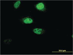 Anti-RNF207 Mouse Monoclonal Antibody [clone: 1C5]