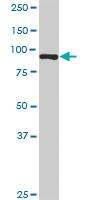 Anti-KIF2C Rabbit Polyclonal Antibody