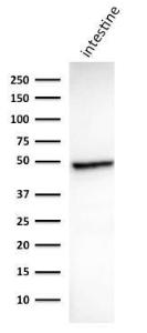 Anti-Cytokeratin 18 antibody