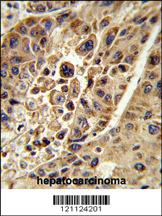 Anti-KMO Rabbit Polyclonal Antibody [clone: 383CT22.2.1]