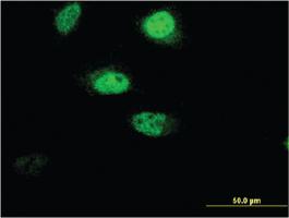 Anti-RNF207 Mouse Monoclonal Antibody [clone: 1C5]