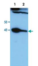 Anti-HAUS8 Rabbit Polyclonal Antibody