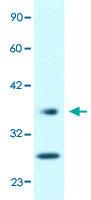 Anti-FOXA3 Rabbit Polyclonal Antibody