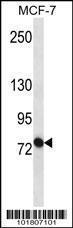 Anti-ABCB10 Rabbit Polyclonal Antibody