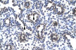 Anti-FOXA3 Rabbit Polyclonal Antibody