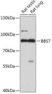 Anti-BBS7 Rabbit Polyclonal Antibody