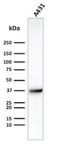 Antibody anti-GLUT1 GLUT12475 BSA 100 µg