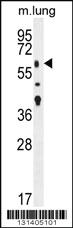 Anti-TGFBR2 Rabbit Polyclonal Antibody