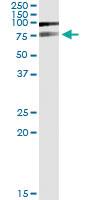 Anti-PIAS2 Polyclonal Antibody Pair