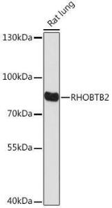 Western blot analysis of extracts of Rat lung, using Anti-RHOBTB2 Antibody (A307145) at 1:1000 dilution