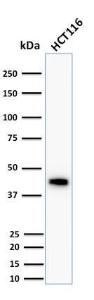 Anti-Cytokeratin 18 antibody