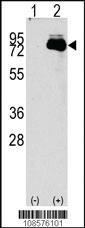 Anti-NUAK2 Rabbit Polyclonal Antibody