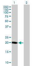 Anti-KCNE1 Rabbit Polyclonal Antibody