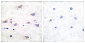 Immunohistochemical analysis of paraffin-embedded human brain using Anti-NMDAR1 (phospho Ser897) Antibody. The right hand panel represents a negative control, where the Antibody was pre-incubated with the immunising peptide