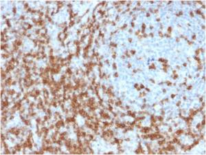 Immunohistochemical analysis of formalin-fixed, paraffin-embedded human tonsil using Anti-CD5 Antibody [CD5/2419]