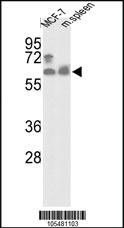 Anti-PANK1 Rabbit Polyclonal Antibody