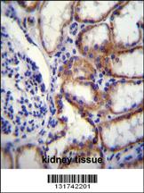 Anti-TMLHE Rabbit Polyclonal Antibody