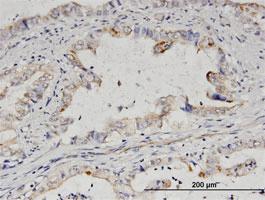 Anti-EPS8L2 Mouse Polyclonal Antibody