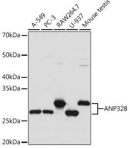 Western blot analysis of extracts of various cell lines, using Anti-PHAPI2/APRIL Antibody [ARC2014] (A307147) at 1:1,000 dilution The secondary antibody was Goat Anti-Rabbit IgG H&L Antibody (HRP) at 1:10,000 dilution Lysates/proteins were present at 25 µg per lane