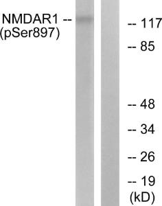 Western blot analysis of lysates from LOVO cells using Anti-NMDAR1 (phospho Ser897) Antibody. The right hand lane represents a negative control, where the Antibody is blocked by the immunising peptide