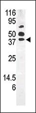 Anti-ATG7 Mouse Monoclonal Antibody