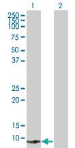 Anti-SPEG Mouse Polyclonal Antibody