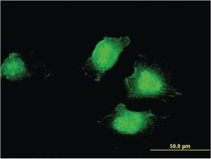 Anti-EDC4 Mouse Monoclonal Antibody [clone: 2E2]