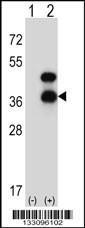 Anti-CD72 Rabbit Polyclonal Antibody (Biotin)