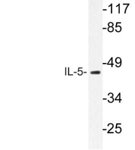 Western blot analysis of lysate from HT 29 cells using Anti-IL-5 Antibody