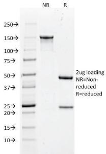 Anti-Cytokeratin 18 antibody