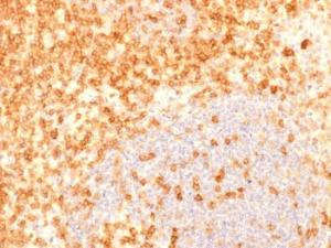 Anti-CD27 Mouse Recombinant Antibody [Clone: rLPFS2/1611]