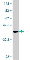 Anti-TTC4 Mouse Monoclonal Antibody [clone: 1E10]