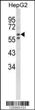 Anti-Hexosaminidase A Rabbit Polyclonal Antibody (APC (Allophycocyanin))