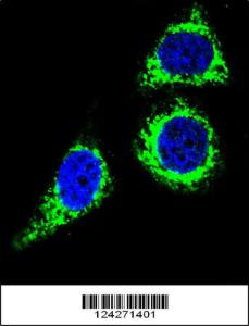 Anti-BCL10 Rabbit Polyclonal Antibody (AP (Alkaline Phosphatase))